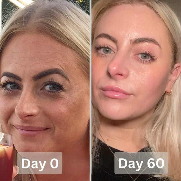PureGlow® Bio-Collagen Real Deep Mask 19 Day 0